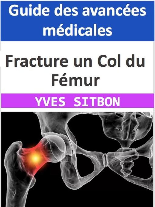 Title details for Fracture un Col du Fémur by YVES SITBON - Available